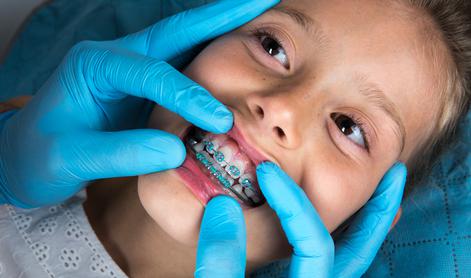 Ortodonti dali predloge za ureditev poraznih razmer #video