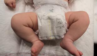 Francozi zasejali dvom: kaj je v otroških plenicah?