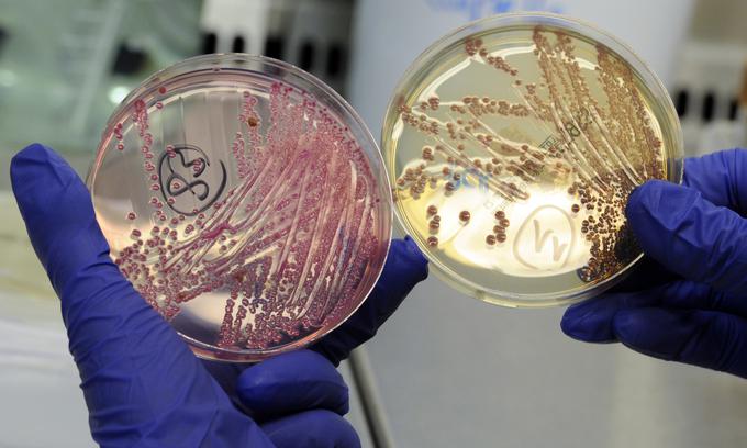 Slovenija pri analizah prisotnosti odpornih bakterij sledi sklepu Evropske komisije za usklajeno spremljanje odpornosti bakterij v vseh državah članicah iz leta 2014. Protokoli določajo vrste in število protimikrobnih substanc, vključenih v testiranje, in mejne vrednosti. | Foto: Reuters