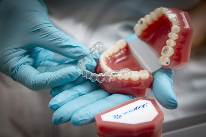 Nevidni zobni aparat Invisalign enostavno snamete, preden si očistite zobe. Čiščenje zob je tako popolnoma enako, kot če ne bi bili na ortodontskem zdravljenju. | Foto: Ana Kovač