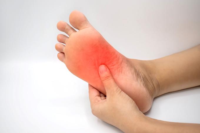 Medicofit_plantarni fasciitis_bolečina | Foto: Medicofit