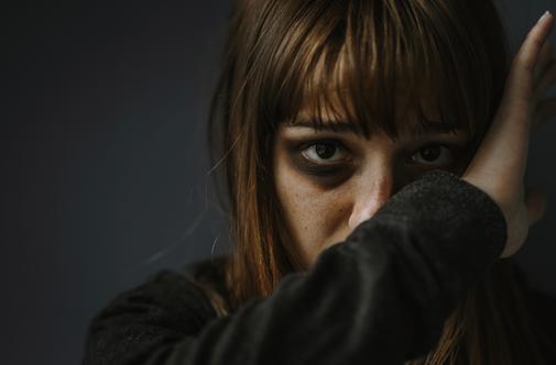 Mati umrla zaradi poškodb brutalnega napada