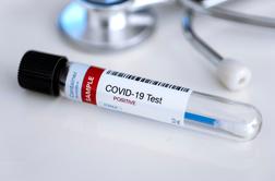 Koronavirus: toliko okužb so potrdili v soboto