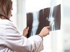 zdravnik rentgen koleno