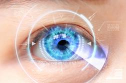Pravila sodelovanja v zbiranju prijav za pridobitev neobvezujočih ponudb za laserske operacije oči