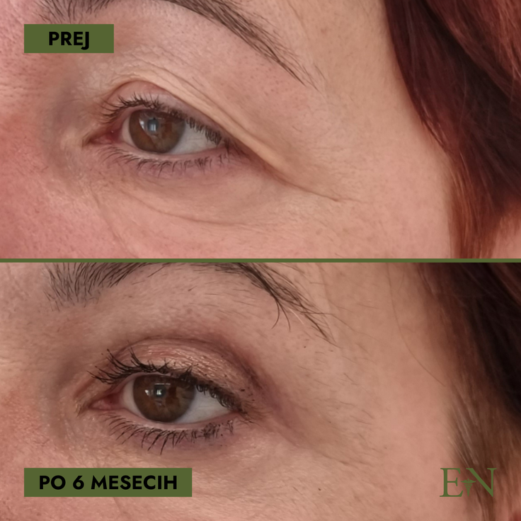 ernest novak lepotni posegi | Foto: Dr. Ernest Novak