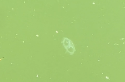 Slovenec posnel meduzo, in to v Zagrebu!