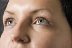 Povešene veke: kako doseči videz bolj odprtih oči?