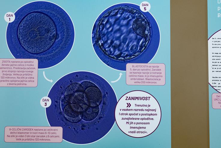 Reproduktivna biologija ne sledi družbenemu premiku, ko se pari kasneje odločajo za starševstvo.  | Foto: Ana Kovač