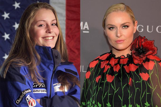 Lindsey Vonn (nekoč Kildow) v letih 2001 in 2017 | Foto: Getty Images