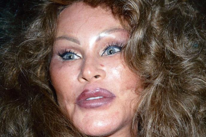 Jocelyn Wildenstein | Prve lepotne popravke je opravila že v 70. letih prejšnjega stoletja, posegi pa so se nato stopnjevali do te mere, da je po mnenju mnogih postala tako rekoč neprepoznavna, njene obrazne poteze pa so spominjale na mačje.  | Foto Profimedia