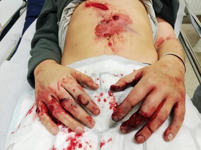 "Starši ali vam je resnično vseeno za svoje otroke, da jim dopuščate uporabo tako nevarnih igrač?"