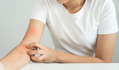 Lupus – zakaj je smiselno obiskati tudi fizioterapevta?