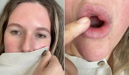 Slovenski kirurg o posnetku s TikToka: Česa takšnega še nisem videl