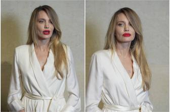 Spremenjena Angelina Jolie: oboževalci se sprašujejo, kaj se je zgodilo
