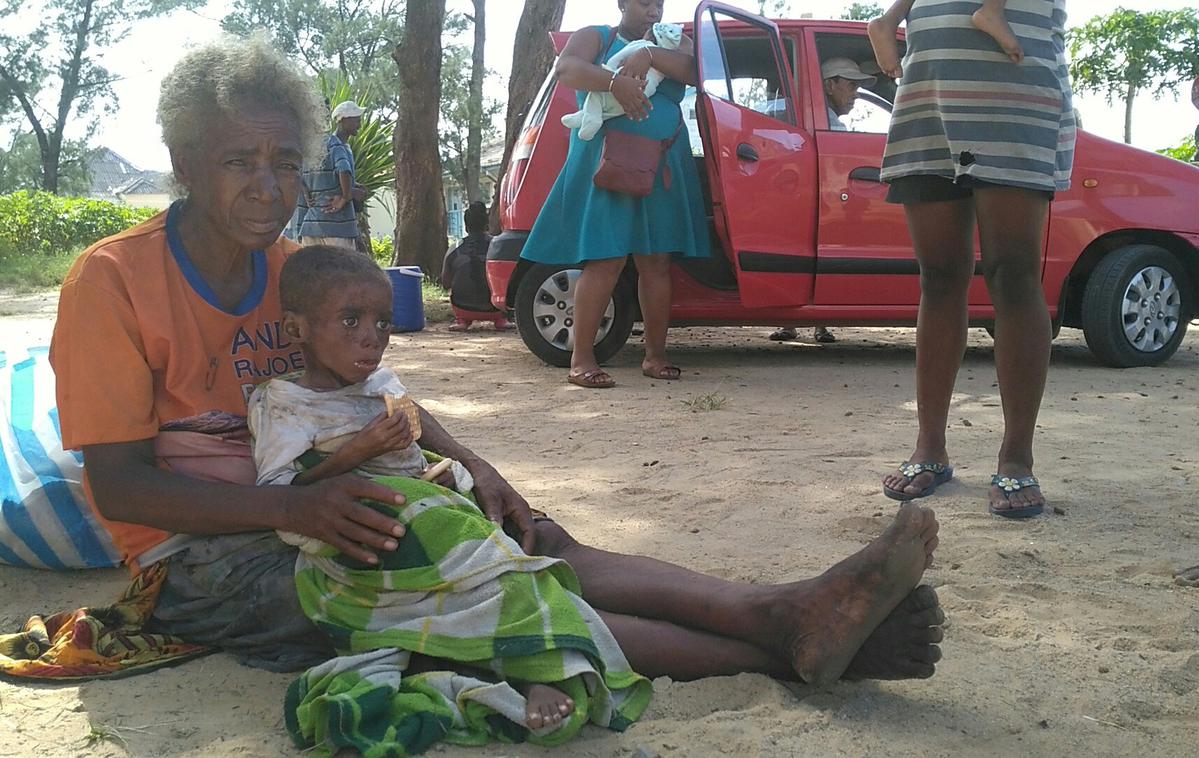 Epidemija ošpic na Madagaskarju | Na Madagaskarju so zaradi epidemije ošpic največ smrtnih žrtev zabeležili med otroki. | Foto Reuters