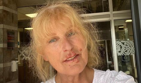Strašljiva diagnoza Zvezdane Mlakar: Danes si, jutri te lahko ni