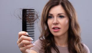 Izpadanje las – Kako preprečiti izpadanje las?