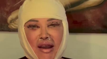 Salome je pokazala rezultat lepotne operacije