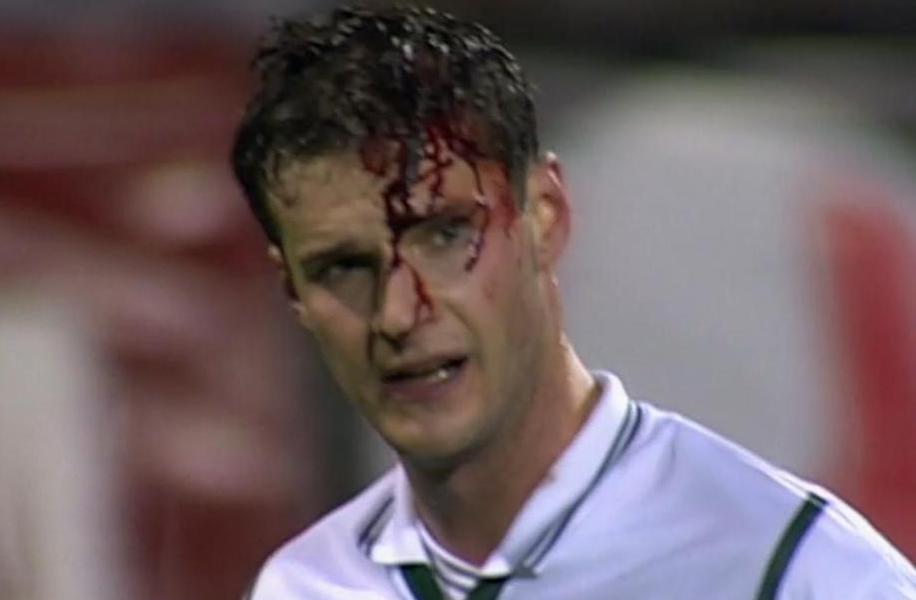 Njegova glava je krvavela, Slovenija pa žarela od ponosa