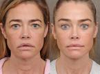 Denise Richards