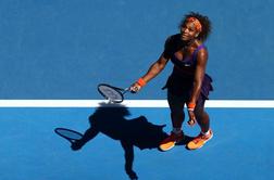 To pa boli: Serena pokazala zatečen gleženj
