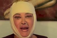 Salome je pokazala rezultat lepotne operacije