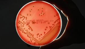 WHO opozarja na vse večjo odpornost bakterij