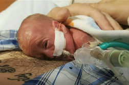 Dojenček, ki velja za medicinski čudež #video