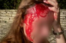 To je poškodba dekleta, ki so jo brutalno napadli varnostniki #video
