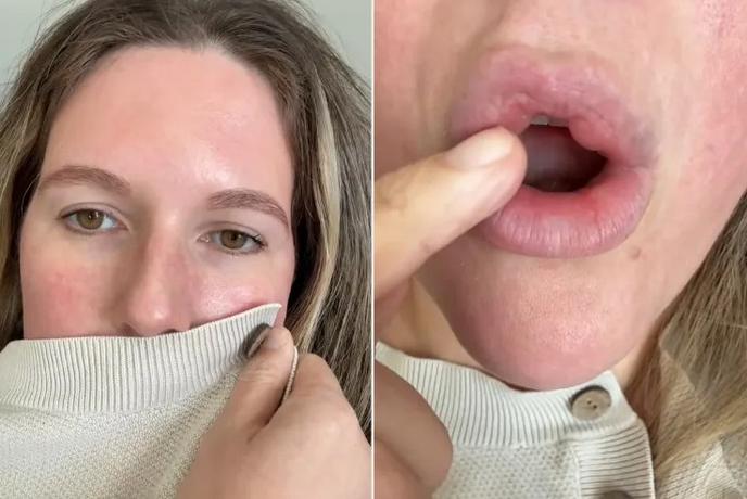 Slovenski kirurg o posnetku s TikToka: Česa takšnega še nisem videl