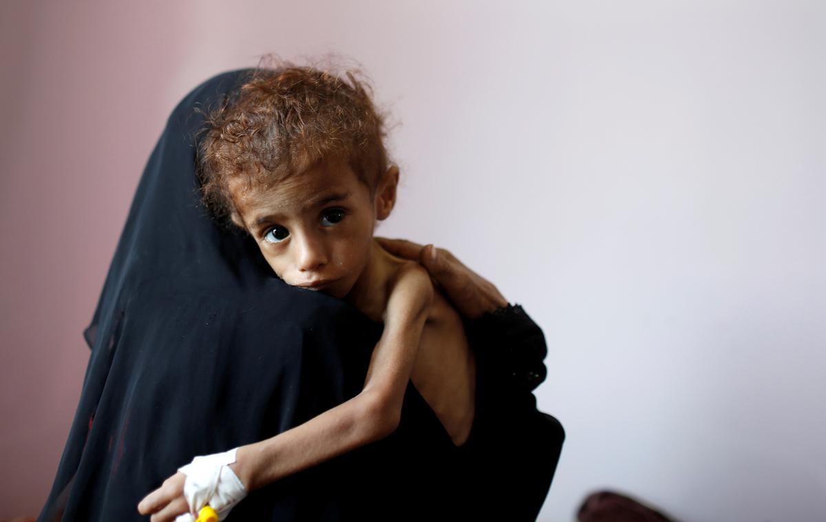 Jemen | Septembra so ocenili, da lakota grozi 11 milijonom ljudi, vendar pa so se razmere v zadnjem času še poslabšale, tako da zadnja ocena znaša 14 milijonov ljudi. | Foto Reuters