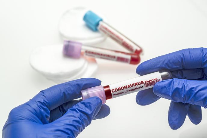 Koronavirus | Foto Getty Images