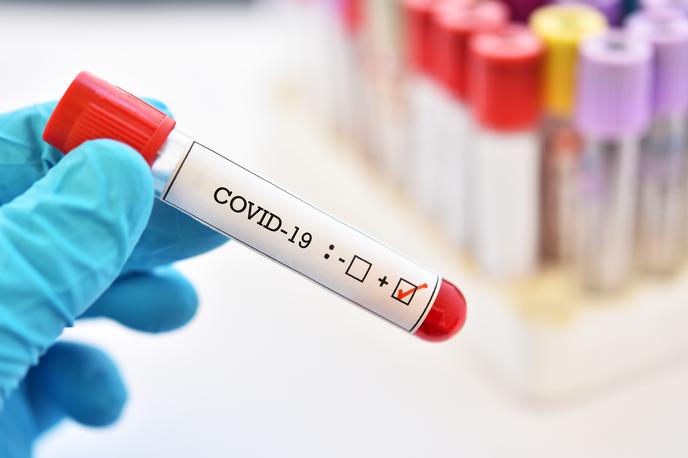 Koronavirus | Za zdaj še ni jasno, ali je zaposlena okužena z novim koronavirusom. | Foto Getty Images
