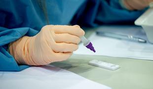 Ministrstvo za zdravje objavilo razpis za nakup milijona hitrih testov