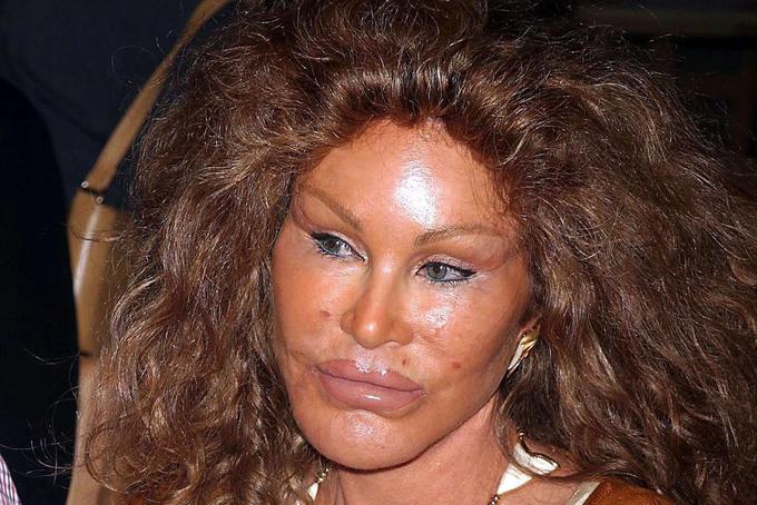 Jocelyn Wildenstein je v zadnjih letih večkrat tarnala, da preživi samo s pomočjo socialne pomoči, ki naj bi znašala okrog 800 evrov mesečno.  | Foto: Profimedia