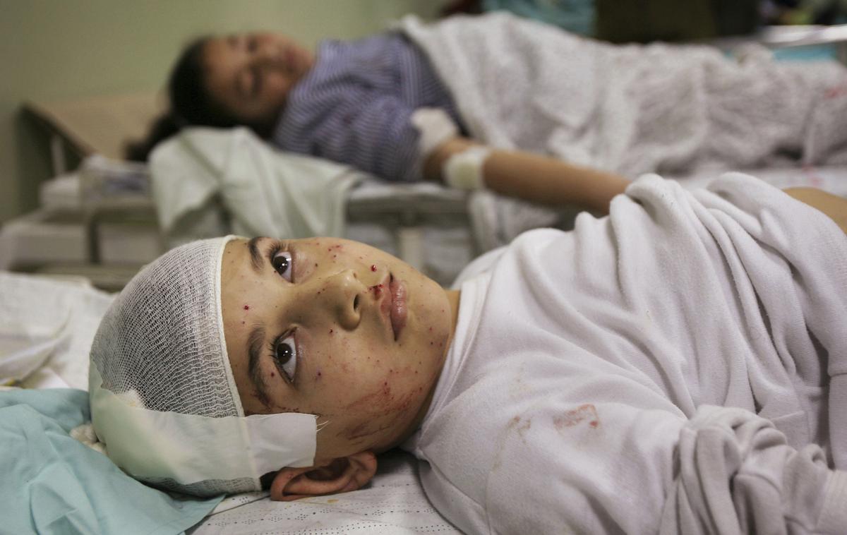 Gaza | Med žrtvami izraelskega bombardiranja Gaze so številni palestinski otroci. Več kot 15 tisoč naj bi jih bilo že ubitih, številni so ranjeni in pohabljeni. | Foto Guliverimage