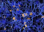nevroni, Alzheimerjeva bolezen