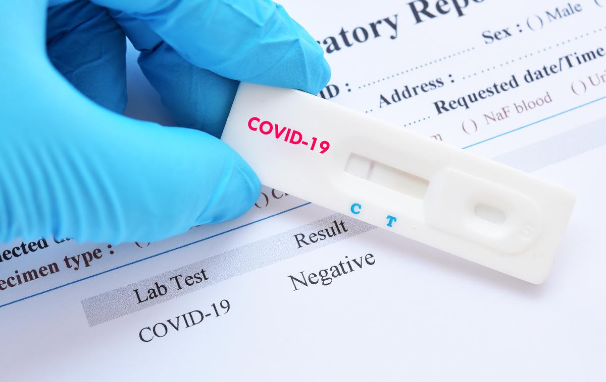 Koronavirus. Cepljenje. Test. Testiranje covid-19. Covid-19 | V primerjavi s prejšnjo soboto, ko so potrdili 188 okužb, jih je bilo včeraj potrjenih 51 več.  | Foto Shutterstock