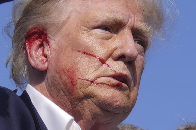 Donald Trump atentat | Donald Trump naj bi bil užaljen, ker ljudje dvomijo, da je bil ustreljen z nabojem. | Foto Guliverimage