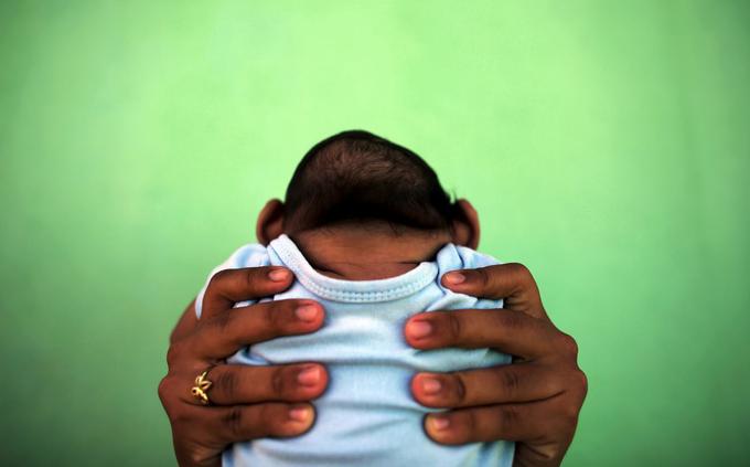 Novorojenček z mikrocefalijo. | Foto: Reuters