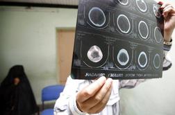 Prepogosti udarci žoge z glavo škodijo možganom