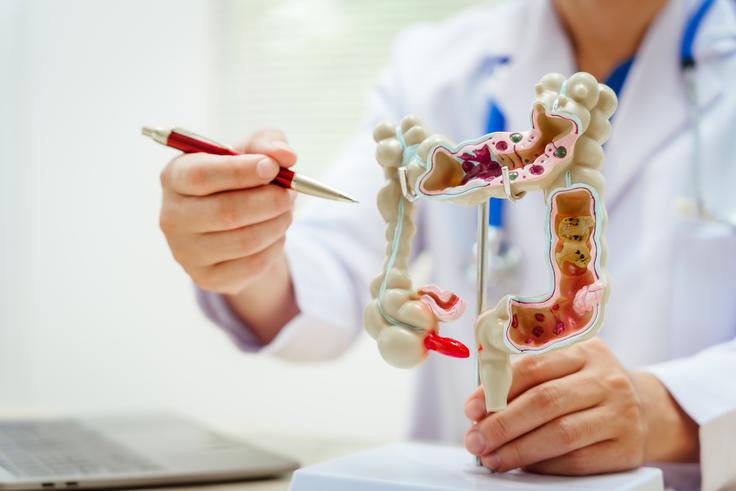 rak prebavil | Foto: Shutterstock