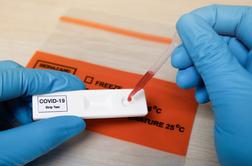 V ZDA odobrili prve teste na okužbo s koronavirusom za domačo uporabo