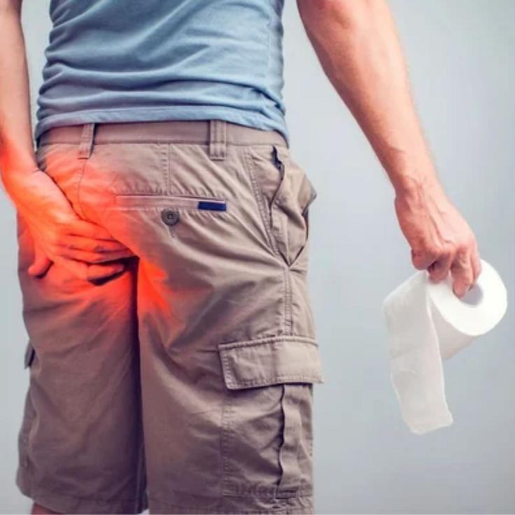 Detralex, hemoroidi | Foto: arhiv naročnika