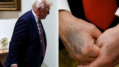 Kje je Donald Trump? Širijo se divje govorice.