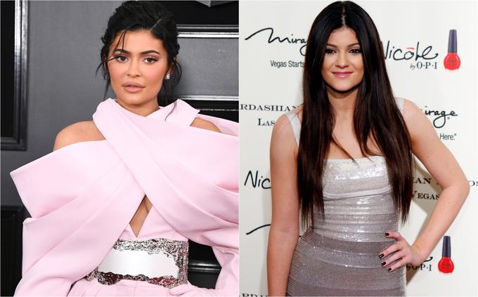 Ustnice Kylie Jenner so pri obiskih estetskih zdravnikov še vedno pogosta tema pogovora. | Foto: Getty Images / Reuters