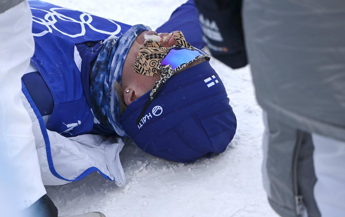 Remi Lindholm | Finski smučarski tekač Remi Lindholm se na nedeljski kraljevski preizkušnji v smučarskem teku, ki je bila zaradi ekstremnega mraza in vetra s 50 skrajšana na 30 kilometrov, boril z omrzlino na skrajno občutljivem mestu.  | Foto Guliverimage