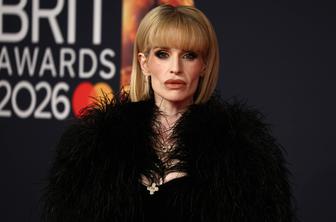 Kelly Osbourne spregovorila o svojem videzu: Nisem bila dobro