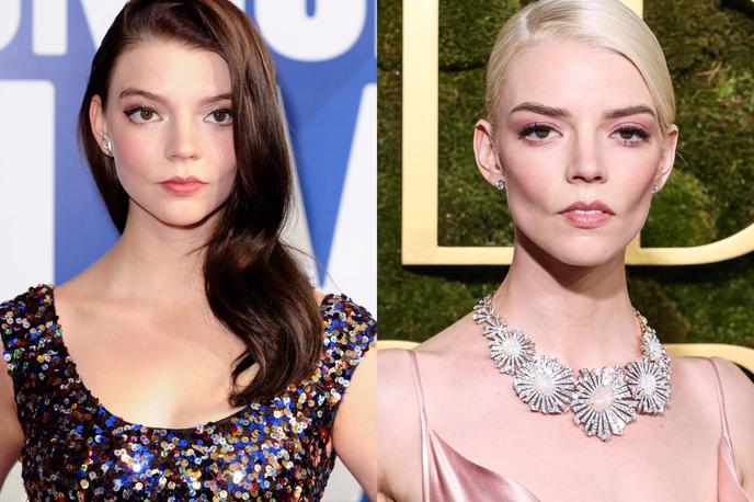 Anya Taylor-Joy | Igralko Anyo Taylor-Joy se najpogosteje omenja, ko je govora o odstranitvi maščobe v licih, čeprav sama posegov ni naslovila. | Foto Guliverimage
